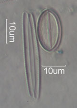 Diatom